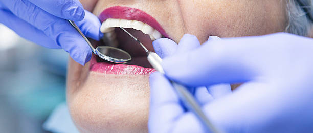 Best Emergency Dental Care for Sports Injuries in Dandridge, TN